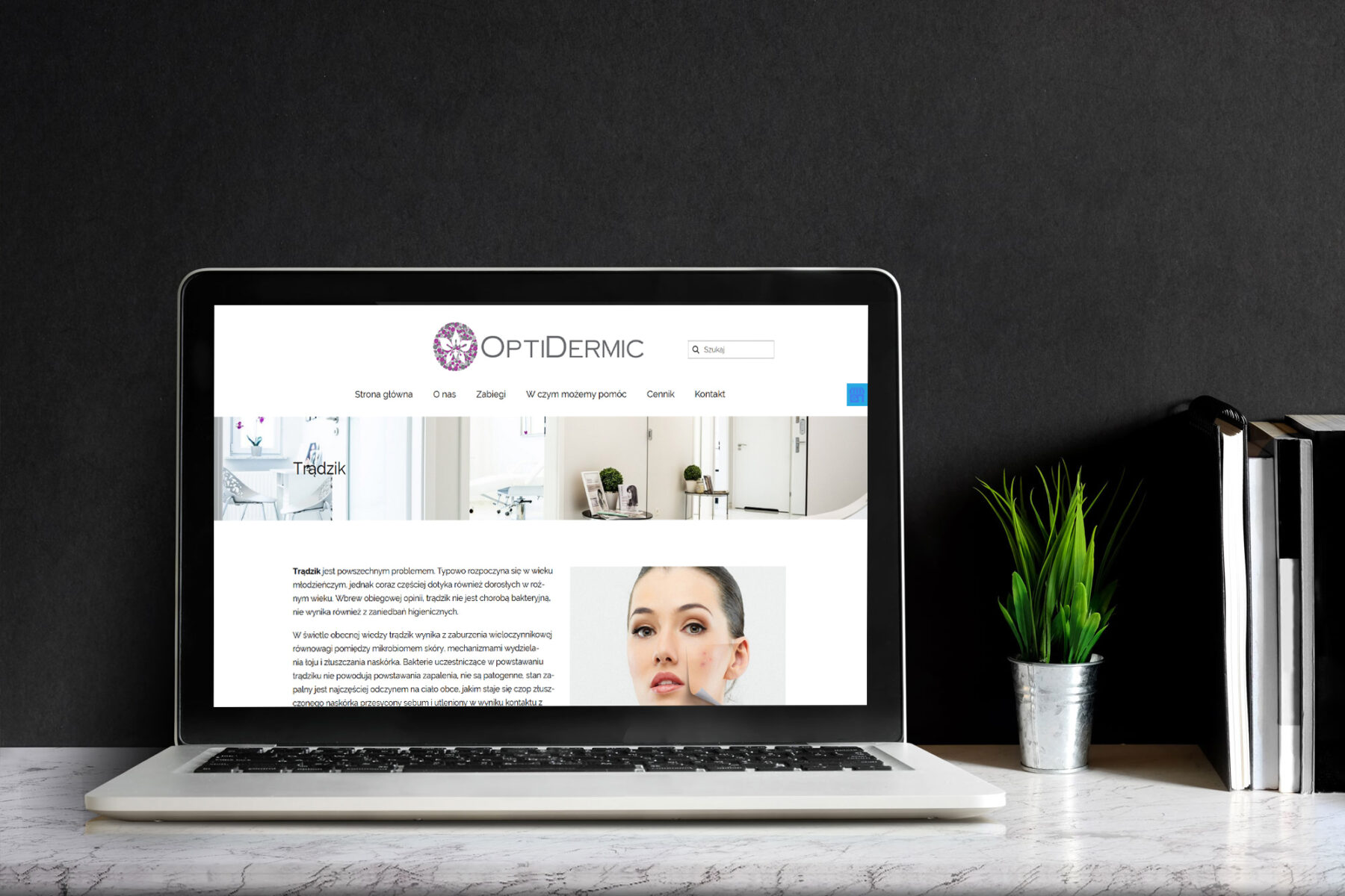 tworzenie stron internetowych optidermic.com by siplex - Obrazek 6